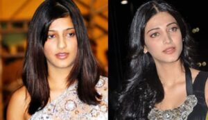 bollywood actress plastic surgery