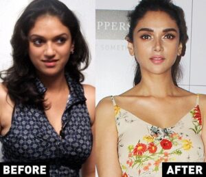 bollywood actress plastic surgery