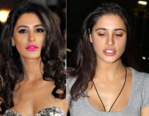 bollywood actress plastic surgery