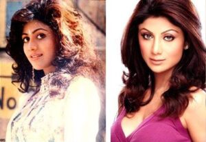 bollywood actress plastic surgery