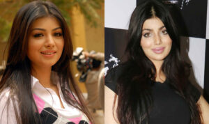 bollywood actress plastic surgery