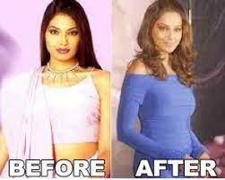 bollywood actress plastic surgery