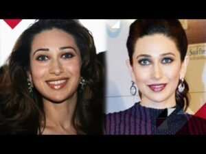 bollywood actress plastic surgery