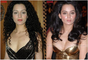 bollywood actress plastic surgery