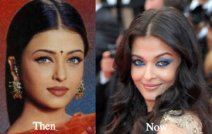 bollywood actress plastic surgery