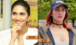 bollywood actress plastic surgery